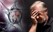 زنگ خطر / هر ۷ دقیقه یک نفر در کشور دچار آلزایمر می‌شود