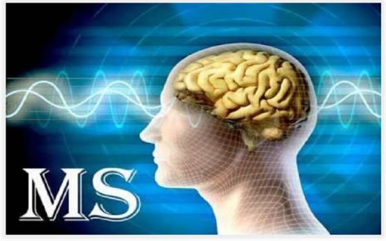 افزایش ابتلا به ام اس/حمایت صندوق بیماریهای خاص و صعبالعلاج از مبتلایان ام اس